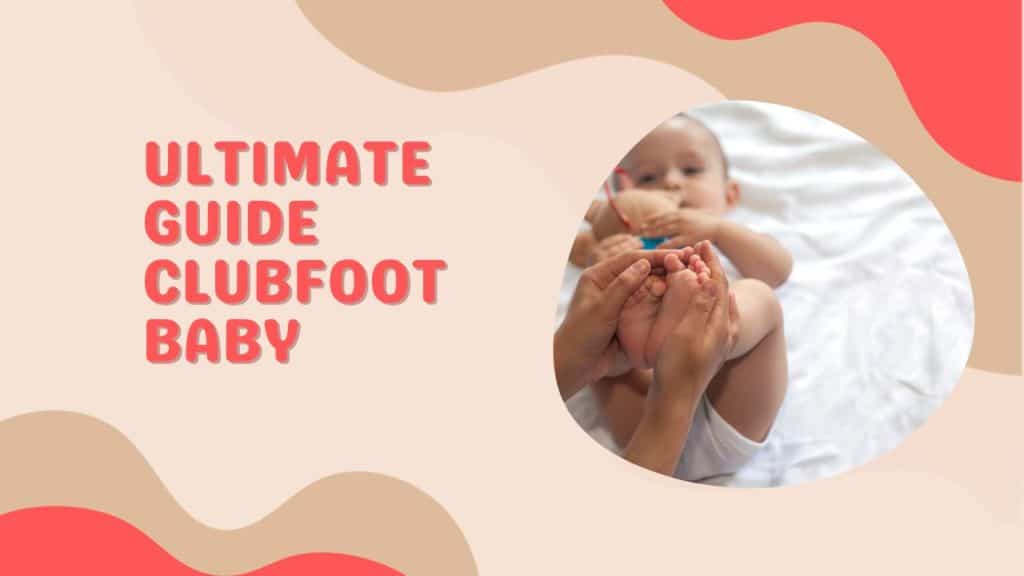Ultimate Guide Clubfoot Baby